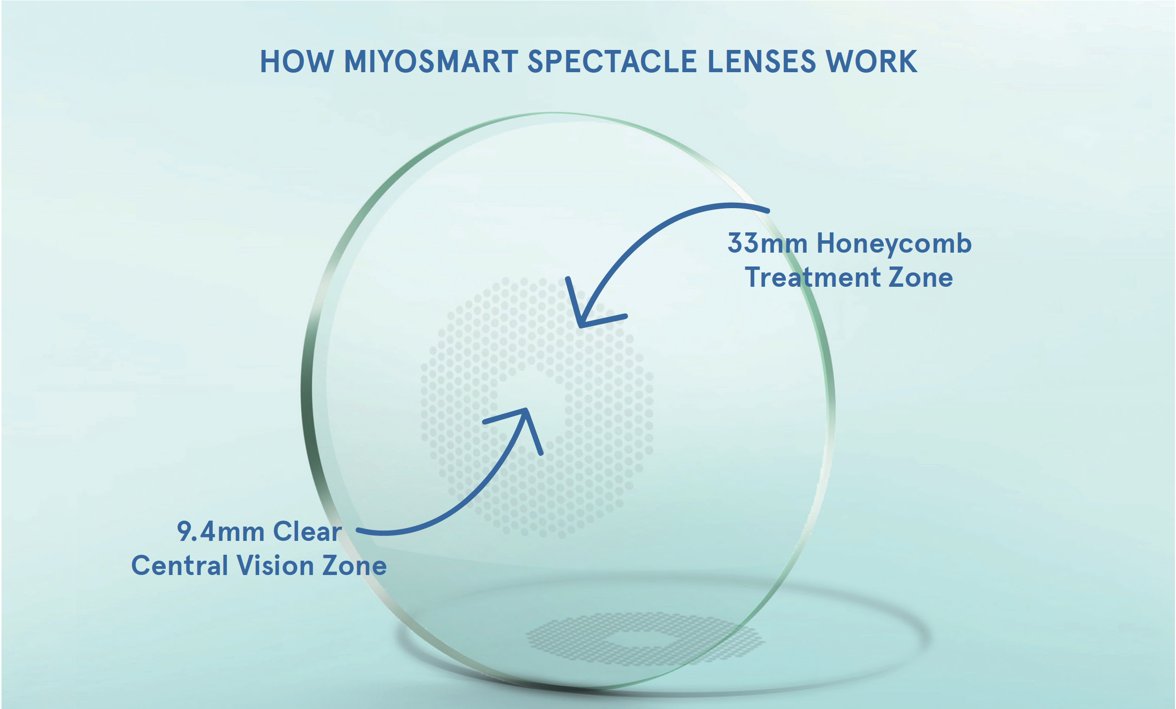 MiyoSmart_Glasses_Lenses_for_Myopia_Management__RSmith 2